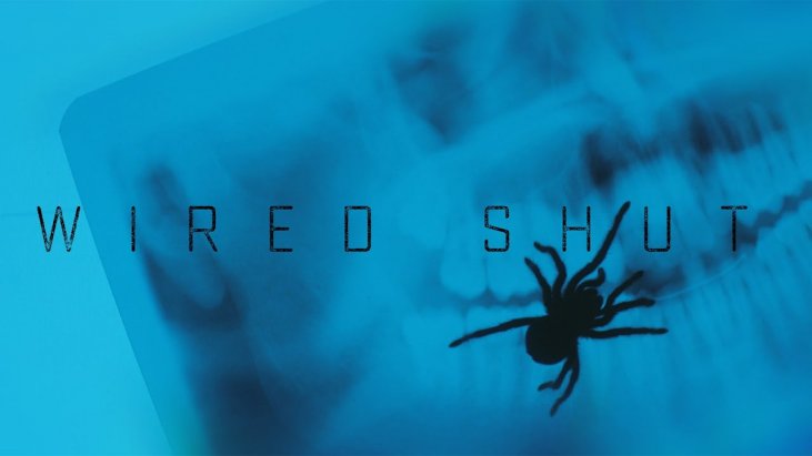 Wired Shut izle